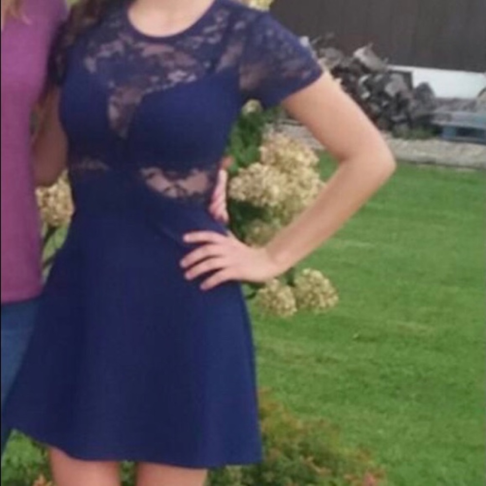 Express navy lace cut out dress. Beautiful🥰